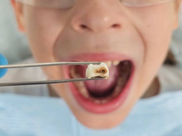 Best Cracked Tooth Emergency Dentist  in Cadott, WI